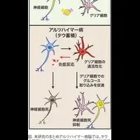 糖代謝とアルツハイマー