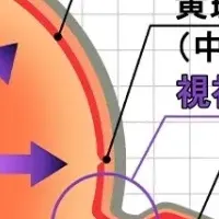 緑内障の正しい知識