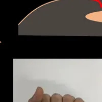 超音波画像の革新