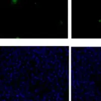 抗真菌薬の新たな可能性