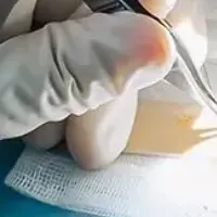 飛んで植毛の魅力