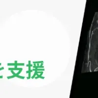脳動脈瘤新モデル