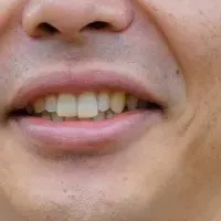 REXEVの挑戦