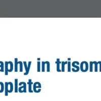 胎児脳マーカー発見