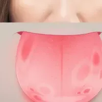 舌の健康と対処法