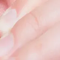 中高年男性の美容