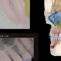 アイキャットとVELMENI