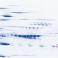 腎がんと更年期の新発見