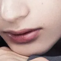 美肌体験
