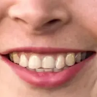 3D骨髄微小環境とは