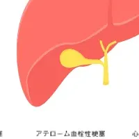 オスラー病講演会