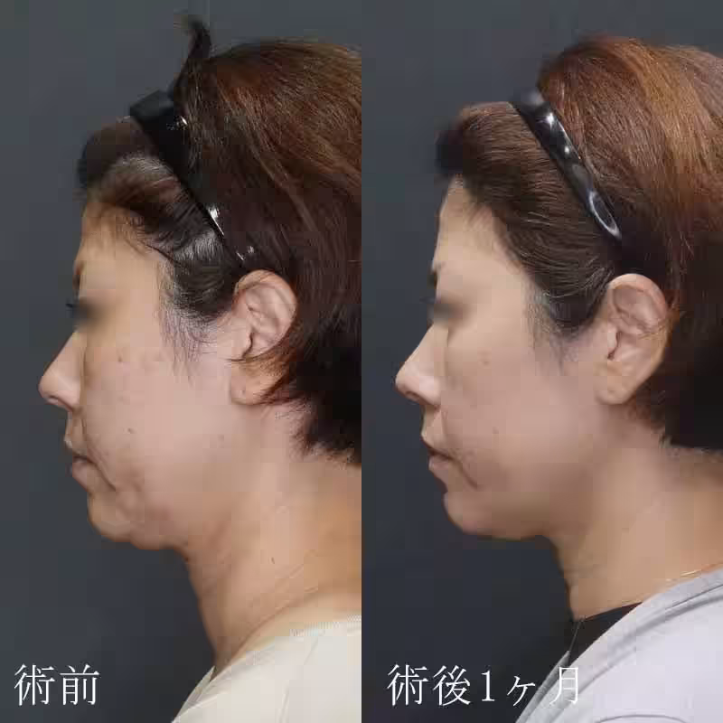 画像16