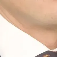 レスメド新体制へ