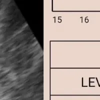 骨盤底トレーニングアプリ