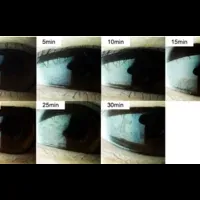 VRでドライアイ軽減？