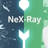NeX-Rayの挑戦