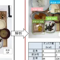 医療現場のAI技術