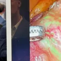 アナウト、米国法人設立