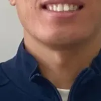 デフリンピックの挑戦