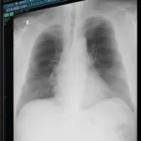 医療AIが進化する