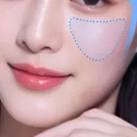 Jfeelクリニックのエムフェイス