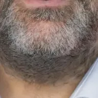 技術提携の発表