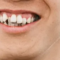 Visban、5Gサミット登壇