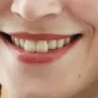 ブロヴキナの挑戦