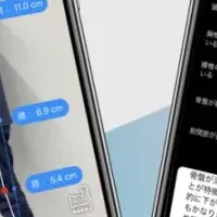 AI姿勢診断導入