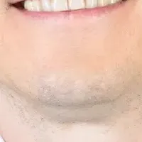 ポーランド大使来場！