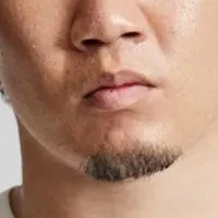 朝倉未来の育毛ブランド