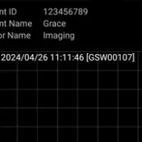 SweatWatch® 許可取得