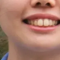 セロオリゴ糖で健康促進