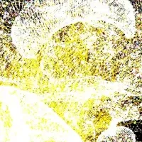 Rab3A変異の発見