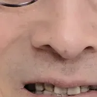 お口の健康セミナー