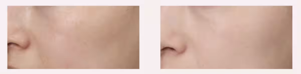画像11
