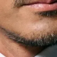 腸から整える健康法