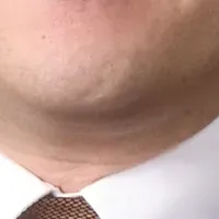 人事制度セミナー